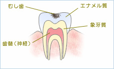 C1