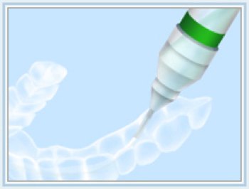 薬剤挿入
