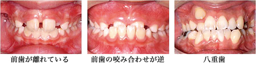 今の歯並び気になりませんか?