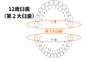 第２大臼歯（１２歳臼歯）のデザイン
