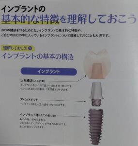 インプラントの基本的な特徴について書かれたページ写真