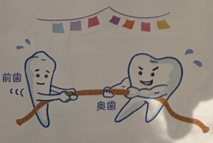前歯の奥歯の綱引きの画像